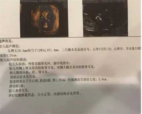(a)代孕机构选性别,杭州助孕机构，杭州试管找哪个医生